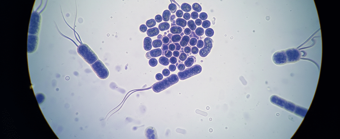 Salmonella: The Hidden Danger Lurking in Your Food